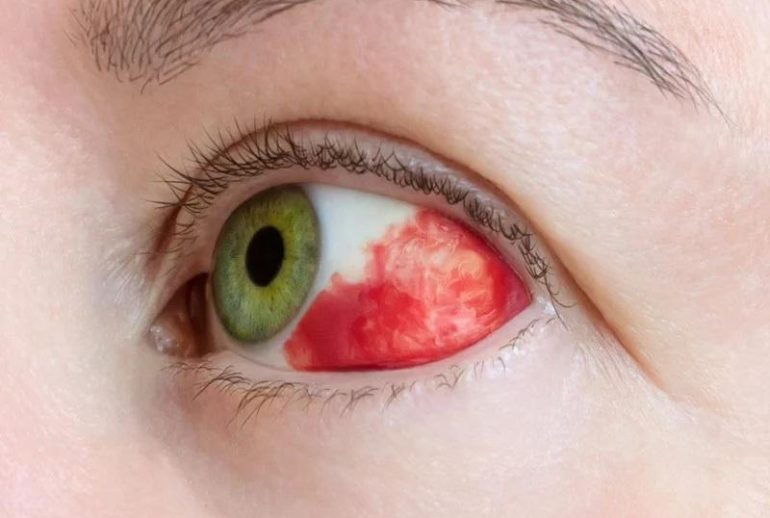 1739540718.067801_545799_image